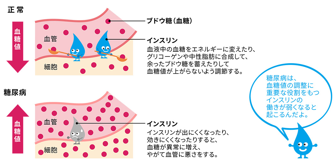 糖尿病（前編～原因と症状）